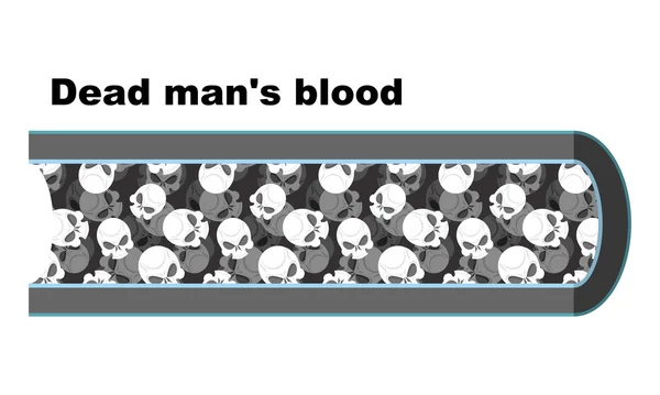 Blood of dead man. Blood cells in the form of skulls. Anatomy of — Stock Vector