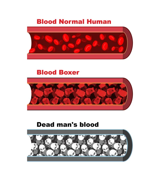 Blood vessel of  healthy person with normal leukocytes. Bloody A — Stock Vector