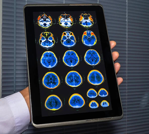 Магнитно Резонансное Цветное Изображение Мрт Головного Мозга — стоковое фото