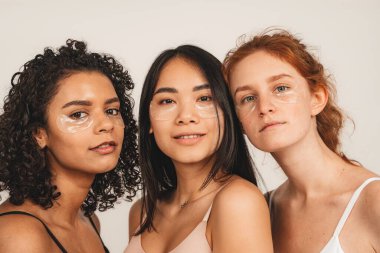 Photo of optimistic cheery young women, multiracial friends wear underwear, with patches under eyes. Concept natural beauty and girl power