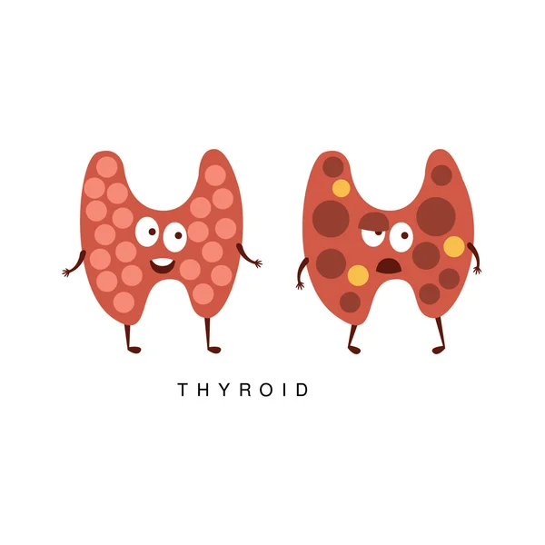 Illustration infographique de la thyroïde saine vs malsaine — Image vectorielle