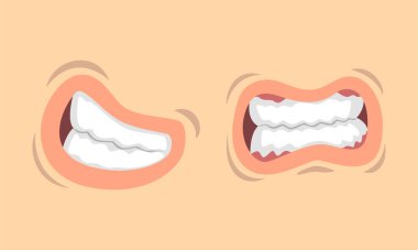 Ağız kıvrımlarının üst ve alt dudakları farklı jest vektörü kümesinde