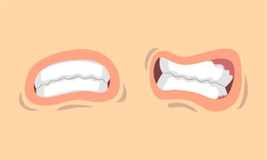 Ağız kıvrımlarının üst ve alt dudakları farklı jest vektörü kümesinde