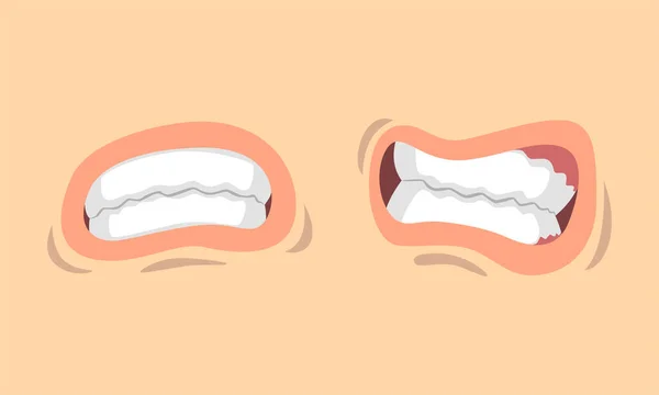 Lèvres supérieures et inférieures de la bouche recourbées dans différents gestes Ensemble vectoriel — Image vectorielle