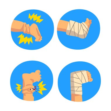 Mavi Çember Vektör Kümesinde Yaralı Bacak İçin İlk Yardım
