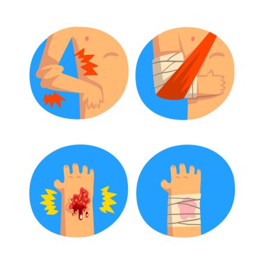 Mavi Çember Vektör Kümesinde Yaralı Kol ve El İçin İlk Yardım