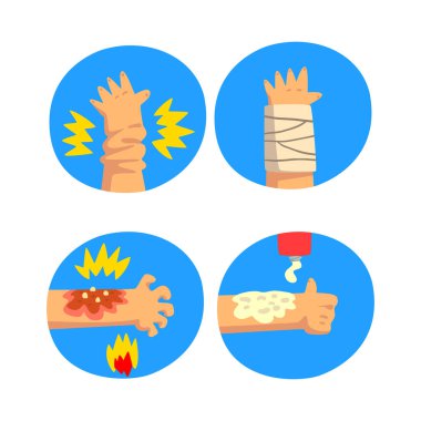 Mavi Çember Vektör Kümesinde Yaralı Kol İçin İlk Yardım