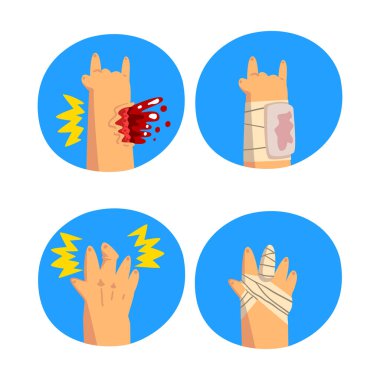 Mavi Çember Vektör Kümesinde Yaralı Kol İçin İlk Yardım
