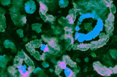 Suluboya Baskı. Koyu yeşil kravat boyalı batik. Parlak Kirli Arkaplan. Kirli Sanat Ressamlığı. Islak Sanat Yazıcısı. Aquarelle dokusu. Banner 'ı fırçaladım. Dark Splash Banner. Kravat boyası. Pembe.