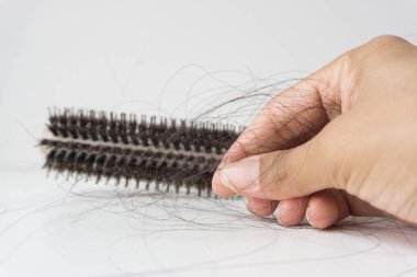 Kadının elinde saç dökülmesi var. Sağlıklı bir sorun..