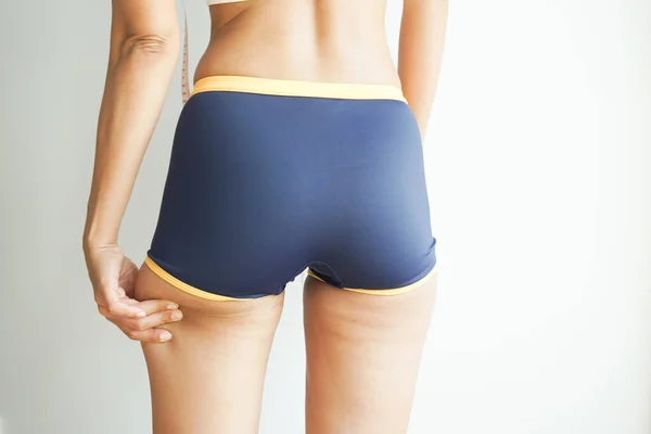 Młoda Kobieta Azjatycki Cellulitem Problem Sprawdzanie Cellulitu — Zdjęcie stockowe
