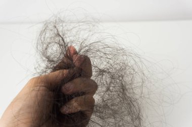 Saçlar elinde, saç dökülme sorunu var..