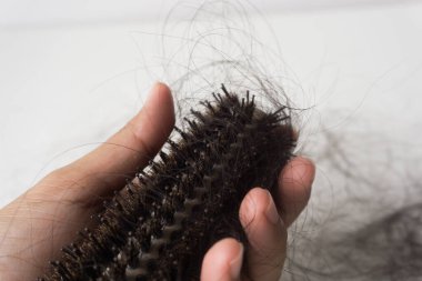 Saçlar elinde, saç dökülme sorunu var..