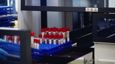 Modern laboratuvar makinası otomatik olarak hastanedeki kan örneklerini kontrol eder..