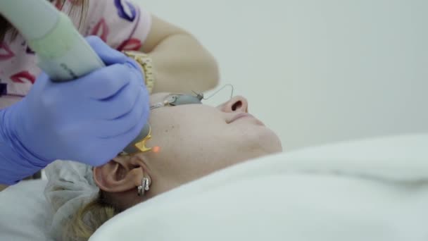 Лазерное удаление кровеносных сосудов на лице замедленное движение — стоковое видео
