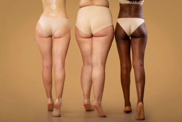 Rear View Of Three Women With Different Body Types In Underwear, Cropped — Stock Photo, Image