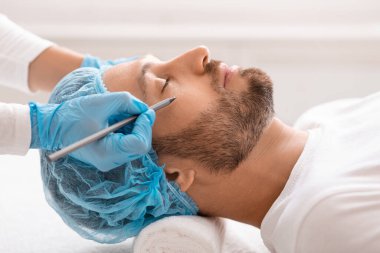 Ameliyattan önce gözlerinin altında kalem izleri bırakan yakışıklı bir adam.