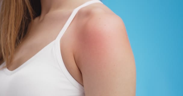 Close up tiro de ombro feminino dolorido com vermelho inflamado ponto pulsante, fundo azul — Vídeo de Stock