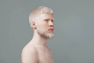 Beyaz tenli, beyaz saçlı, gri stüdyo arka planında poz veren albino tişörtsüz adam.