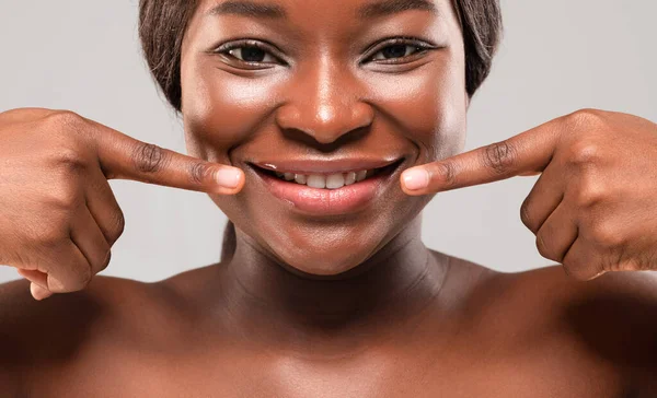 Lipverzorging concept. Mooie glimlachende zwarte vrouw wijzend naar haar mollige lippen — Stockfoto