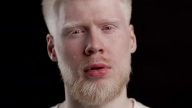 Albino Adam Siyah Arkaplanda Kameraya Bakarken Ağlıyor