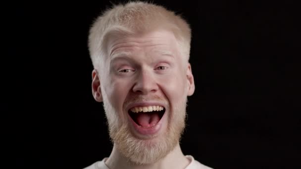 Albino Man Blinking Eyes And Opening Mouth Over Black Background — Stock Video