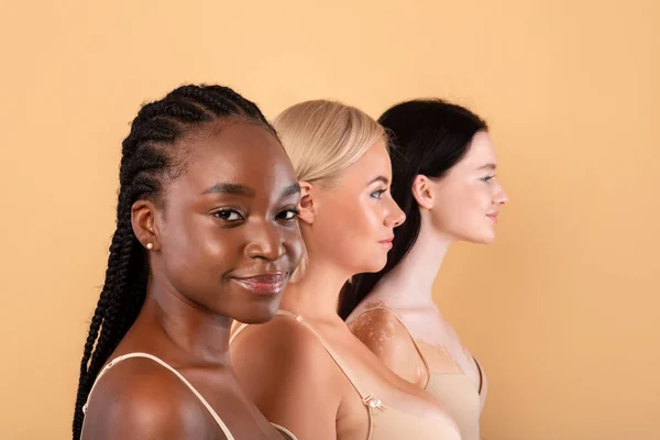 Três mulheres bonitas de raça diferente e pele posando sobre fundo bege — Fotografia de Stock