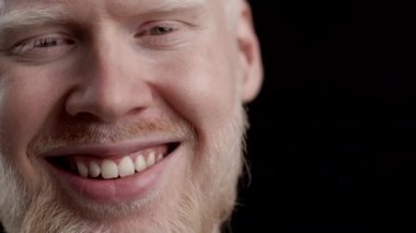 Albino Adam Siyah Arkaplanda Kameraya Gülümseyen Adam, Yakın plan