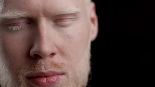 Albinos homme regardant caméra posant sur fond noir, Gros plan — Video