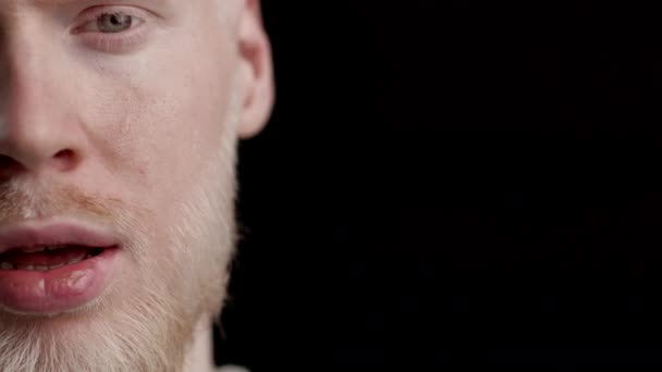 Полуобнаженный портрет парня-альбиноса, плачущего на черном фоне — стоковое видео