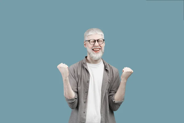 Overjoyed albino guy screaming in excitement, gesturing YES with both hands on turquoise studio background — Stock Photo, Image