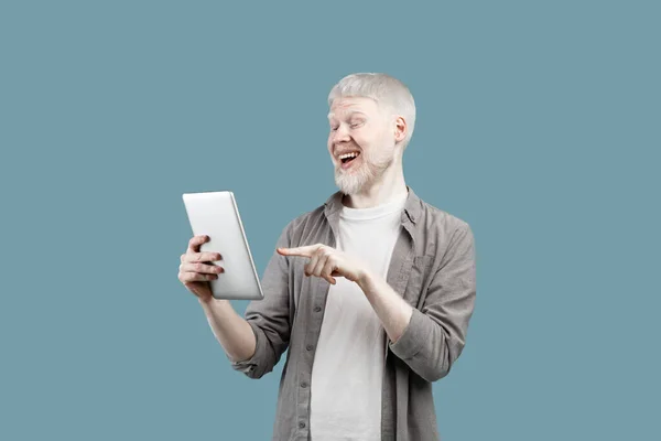 Great ad and amazing news. Overjoyed albino man holding digital tablet and looking at screen over turquoise background — Stok fotoğraf