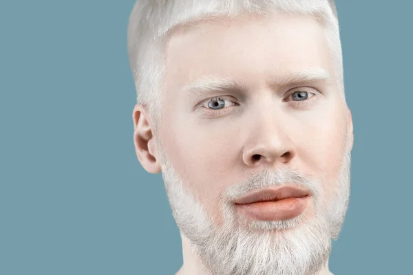 Albinism concept. Portrait of young bearded albino man with white hair, pale skin and blue eyes, turquoise background — Photo