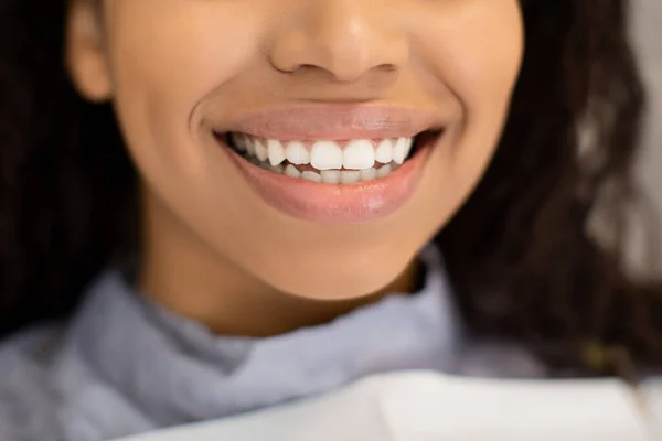 Closeup Of Unrecognizable Black Lady Widely Smiling With Her Perfect White Teeth — ストック写真