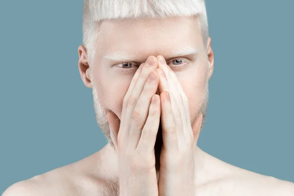 No way. Albino guy covering mouth with both hands and looking at camera, standing speachless over blue background — Stok fotoğraf