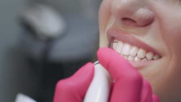 Close up tiro de médico dentista fazendo procedimento de limpeza profunda preventiva para paciente do sexo feminino com sorriso branco perfeito — Vídeo de Stock