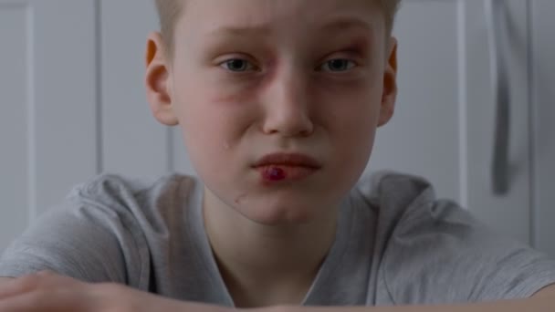 Violences domestiques et distractions des enfants. Agacé battu pleurer petit garçon avec des blessures sur le visage tournant la tête vers le haut — Video