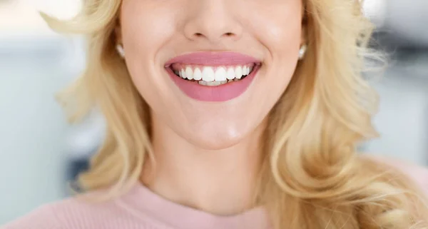 Blondine dame met mooie witte tanden, bijgesneden — Stockfoto