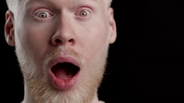 Σοκαρισμένος Albino Guy κοιτάζοντας κάμερα πάνω από το μαύρο φόντο — Αρχείο Βίντεο