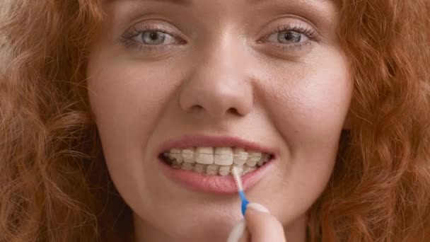 Kvinna med hjälp av tandborste rengöring tänder med hängslen, Beige bakgrund — Stockvideo