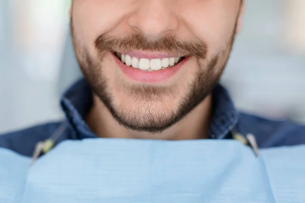 Erkek dişçi kliniğine yakın, beyaz, sağlıklı gülümseme. — Stok fotoğraf