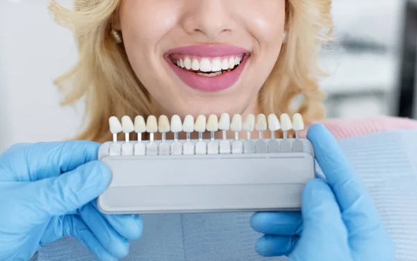 Dentista aplicando amostra da escala de dentes aos dentes brancos do paciente — Fotografia de Stock