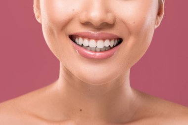 Gülümseyen bir kadın, kusursuz beyaz dişlerini gösteriyor. Bu yakın çekim, dişçi bakımı ve hijyenin önemini vurgulayarak, yumuşak mor bir arka plana karşı onun sağlıklı gülümsemesini vurguluyor..