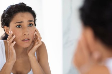 Bir kadın banyo aynasının önünde durmuş yüzüne dokunurken endişeli endişeli endişeli bakıyor. Sıradan giyinmiş ve sabah erkenden cilt durumunu değerlendiriyor gibi görünüyor..