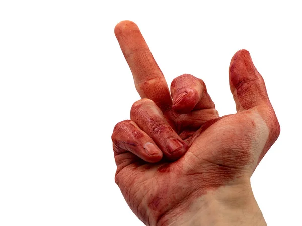 Man Bloody Hand Shows His Middle Finger White Background Gesture — Φωτογραφία Αρχείου