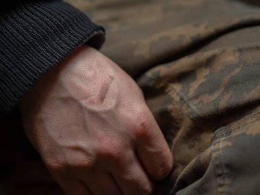 Soğuk ısırması olan bir askerin ya da işçinin kirli erkek eli..