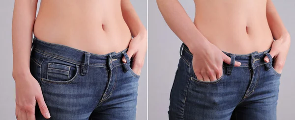 Weight loss results before and after. Belly fat and muffins burning — Stockfoto