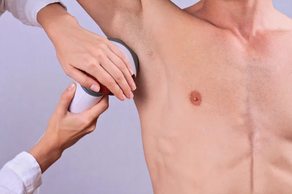 Remoção de cabelo a laser para homens — Fotografia de Stock