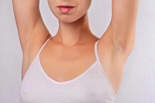 Armpit epilation, lacer hair removal. Young woman holding her arms up and showing underarms, armpit, ideal smooth clear skin — 스톡 사진