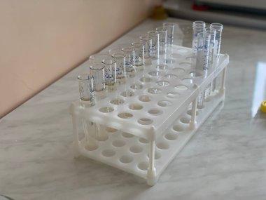 The test tubes with blood stand in a rack in the laboratory for analysis.